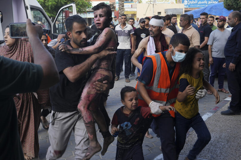 Palestinians wounded in the Israeli bombardment of the Gaza Strip are brought to a treatment room of al Aqsa Hospital in Deir al Balah, Oct. 31, 2023. (AP Photo/Adel Hana)