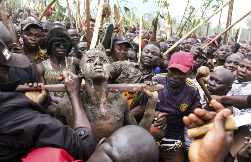 Daniel Wabuyi reacts during his traditional circumcision ritual, known as Imbalu, at Kamu village in Mbale, Eastern Uganda. Aug. 3, 2024. (AP Photo/Haiarah Nalwadda) 